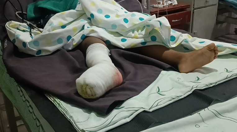 El niño de tres años tiene complicaciones en el pie derecho. Foto. Soledad Prado