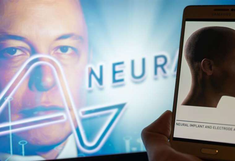 Elon Musk Anuncia El Primer Implante De Un Chip En El Cerebro De Un ...