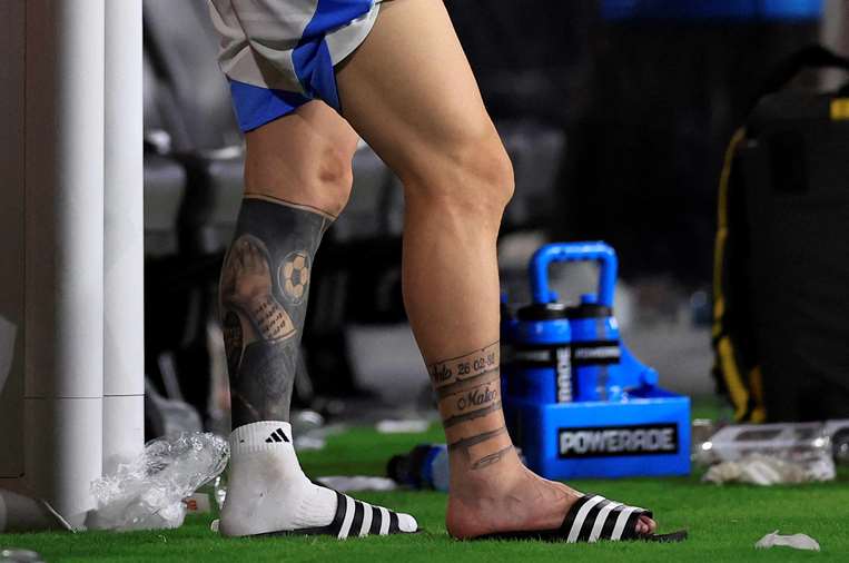 Pie lesionado de Lionel Messi /Foto: AFP